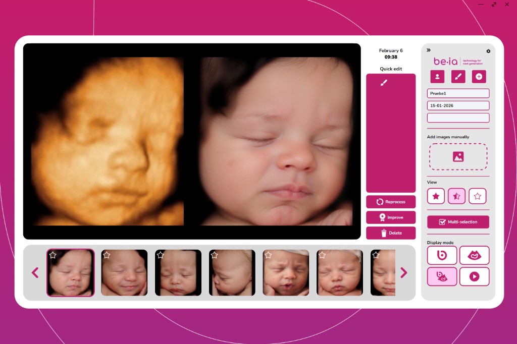 Web app de Be·ia para subir ecografías 3D, 4D o 5D