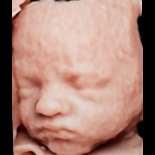 Ultrasonido original del rostro del bebé, ejemplo para clínicas